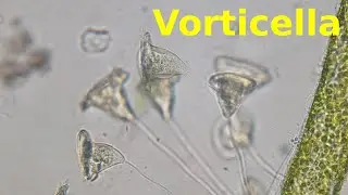 Vorticella - Under the Microscope