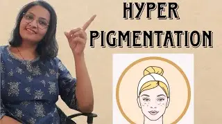Hyperpigmentation(uneven skin tone) #skincare #hyperpigmentation #unevenskintone #melasma #darkspots