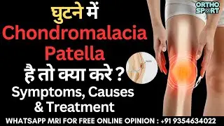 घुटने में Chondromalacia Patella है तो क्या करे ? Symptoms, Causes & Treatment