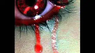 Secondhand Serenade - it's not over (cover by audamour)