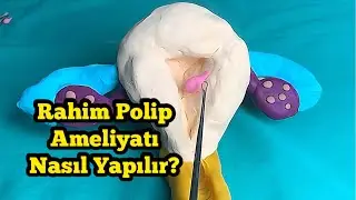 🩸 Rahim Polip Ameliyatı Nasıl Yapılır? - Op. Dr. Funda Yazıcı Erol