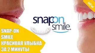 😁 Виниры люминиры или ультраниры что выбрать ✔ Купить виниры в санкт петербурге 😎