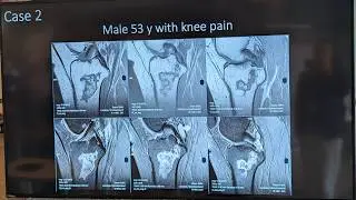 Radiology Quiz Case 2 (ESSR 2024) - solved... or not?