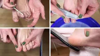 Как делать кислотный педикюр в домашних условиях