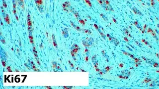 Counting Ki67 using ImageJ software