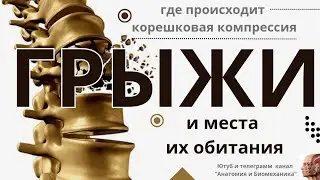 Грыжи. Корешковая компрессия.