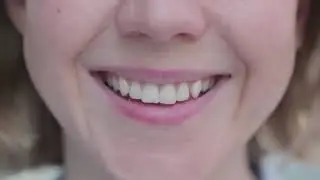 Hollywood Teeth Whitening At Home - The Teeth Clinic is the answer of all your oral health problems.
