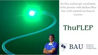 En-bloc endoscopic enculeation of the prostate with thulium fiber laser
