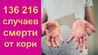 Заболеваемость корью выросла на 79%