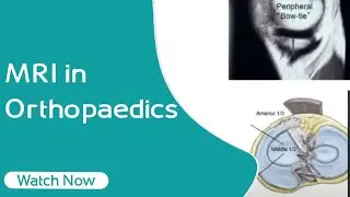 MRI in Orthopaedics | Orthopaedic Academy