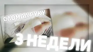 СЛОМАЛ РУКУ//ПИРИ