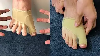 BUNION BRACE