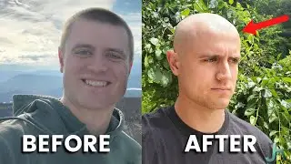 Going BALD over Creatine Monohydrate