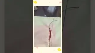 Teknik Penjahitan Luka Perineum