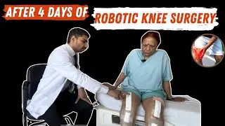 After 4 days of robotic knee surgery
