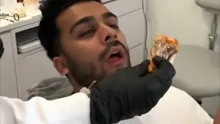 When u haven't been to the dentist in a while ( adamw )