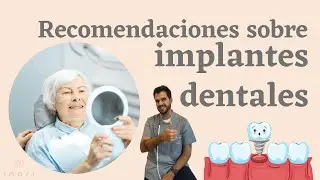 Recomendaciones generales sobre implantes dentales