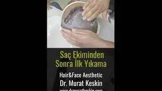 Saç Ekimi Sonrası İlk Yıkama
