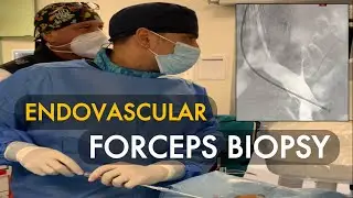 Interventional oncology: endovascular forceps biopsy after inferior vena cava filter deployment