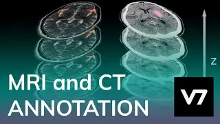 MRI and CT Image Annotation - V7 AI Academy