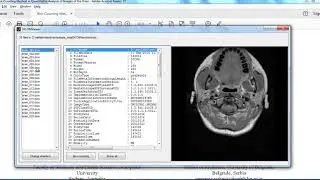 matlab based mini projects | matlab based mini thesis | matlab based mini projects code