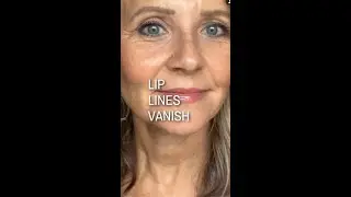 Lip Lines Vanish