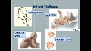 Differences between Grasp Reflex and Moro Reflex (Startle reflex) seen in Babies