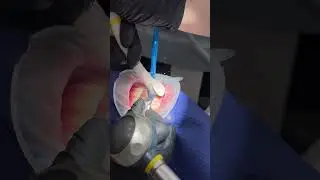 Чистим зубы