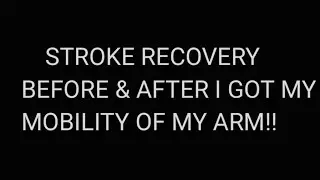 STROKE RECOVERY: BEFORE & AFTER I GOT MY MOBILITY   OF MY ARM!!..part 1#stroke#therapy #rehab