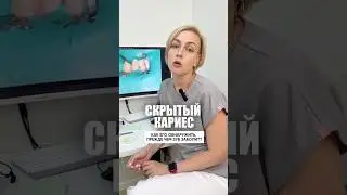 Гигиена раз в полгода позволит вовремя обнаружить скрытые процессы и сохранить зуб