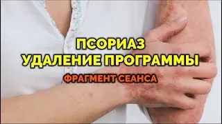PSORIASIS. Program Removal. Energy Cleansing Session