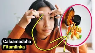 6- calaamad oo isku arki karto hadii fitamiinkaan jirkaada ku yaryahay