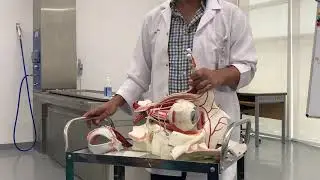 Ophthalmic artery (Neuroanatomy 40)