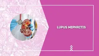 Lupus Nephritis