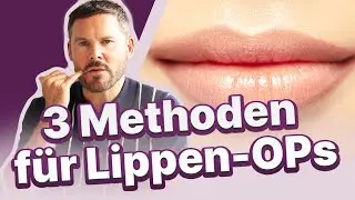 Verschiedene Methoden für Lippen-OPs – Die „dauerhafte“ Alternative zu Hyaluron?