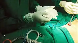 Boobs Ki Size badhane ke liye Surgery hoti he? Breast Implant Surgery in Vesu, Surat, Gujarat.