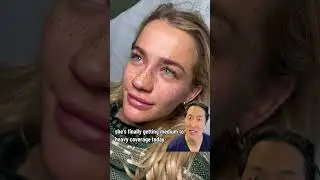 Doctor Reacts to Freckle Tattoos! #freckles #tattoo