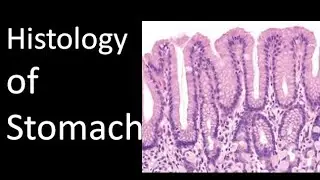 Histology of stomach 