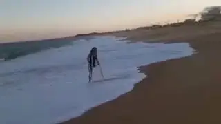 amputee women love