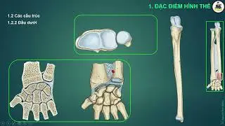 CHI TRÊN: XƯƠNG TRỤ (PPT)