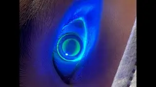 Decoding Corneal Topography for Smart Contact Lens Decisions