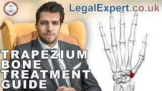 Trapezium Bone Injury Treatment Guide ( 2021 ) UK
