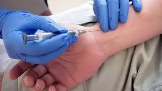 ABG PROCEDURE (INTERNSHIP LEARNING)