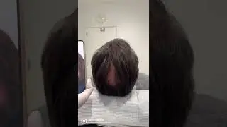 Hairfiller before & after