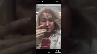 Вижившая девочка из Чернигова после сброса бомбы на школу