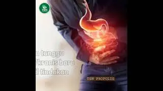 TSN PROSEHAT PROPOLIS adalah Propolis dengan bahan baku Green Brazilian Propolis