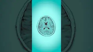 Scientists Created a Brain In Lab, and It Started Growing