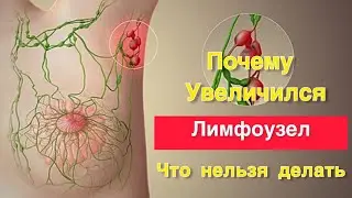 Почему увеличился лимфоузел. Что делать нельзя 🚫