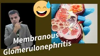 Cracking The Code: Understanding Membranous Glomerulonephritis#pathology