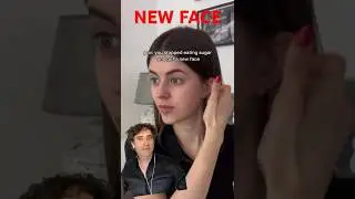 STOPPED SUGAR GOT NEW FACE